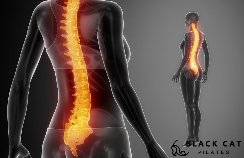 春のスカートが決まらない原因?猫背から連鎖する「反り腰」の罠